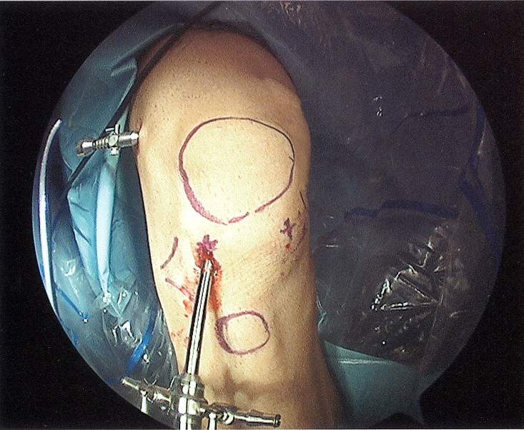 Name:  knee.jpg
Views: 270
Size:  159.0 KB