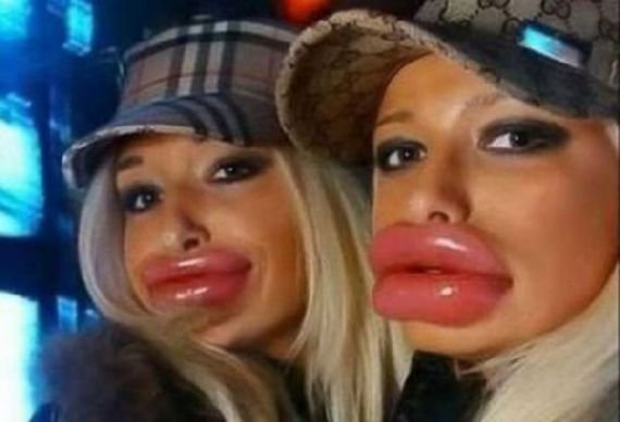 Name:  ducklips.jpg
Views: 211
Size:  29.3 KB