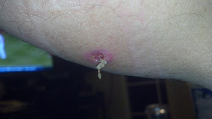 Name: stitches.jpg
Views: 306
Size: 34.3 KB